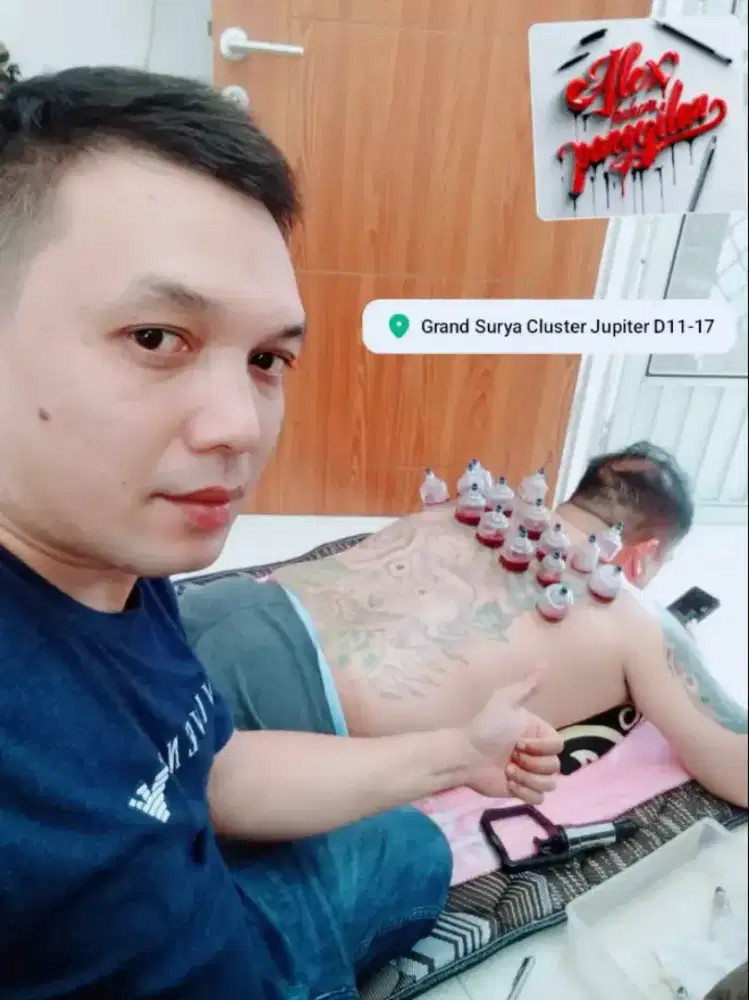 Jasa bekam panggilan