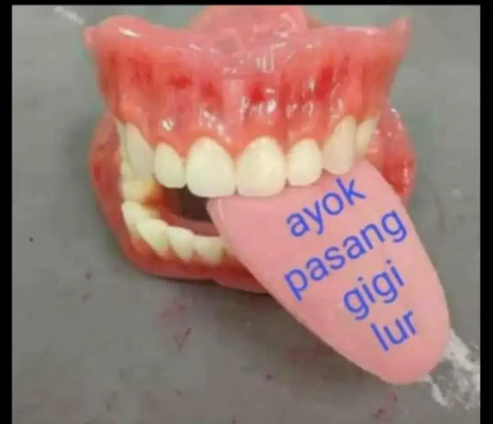 Ihsan gigi